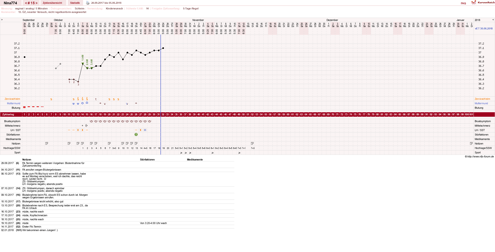 NFP-Kurve User #29626