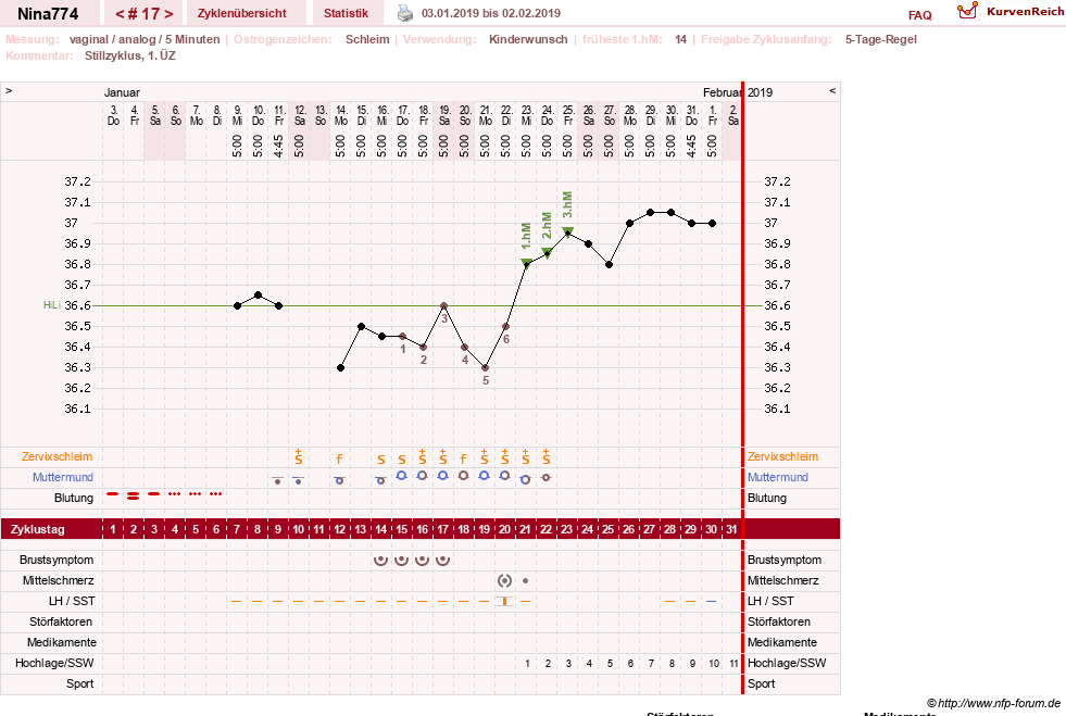 NFP-Kurve User #29626