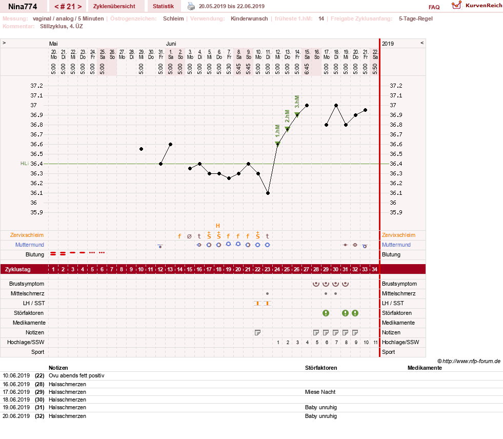 NFP-Kurve User #29626