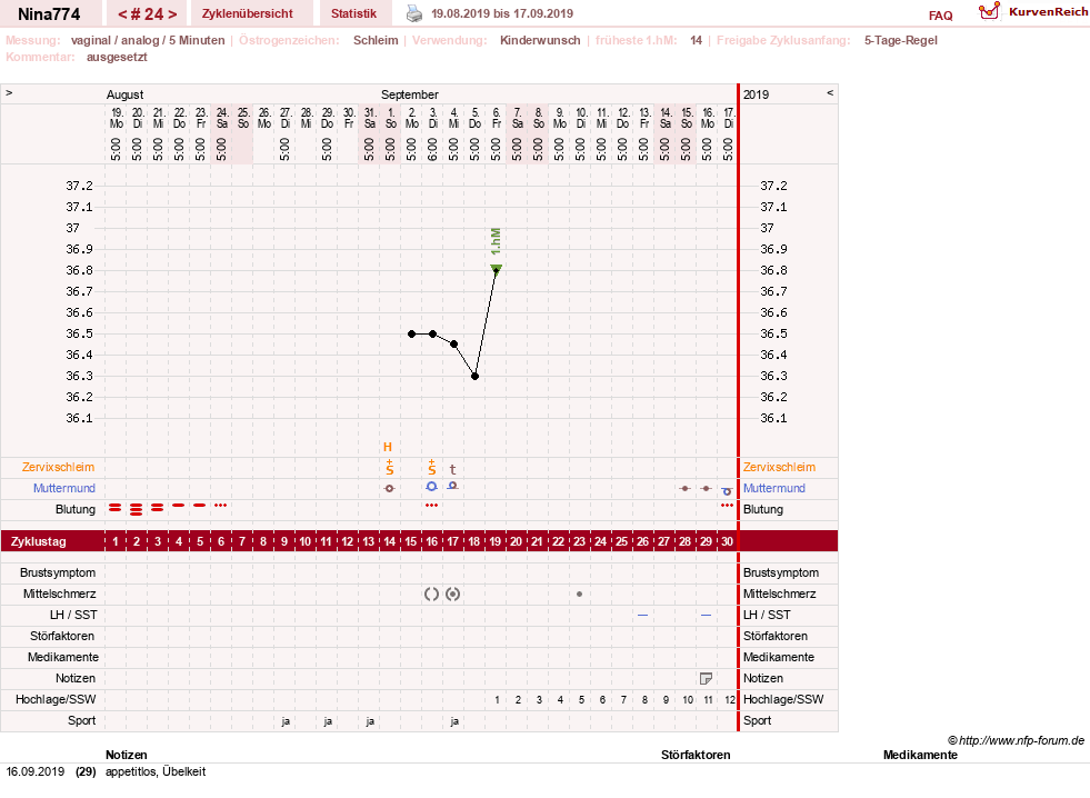 NFP-Kurve User #29626