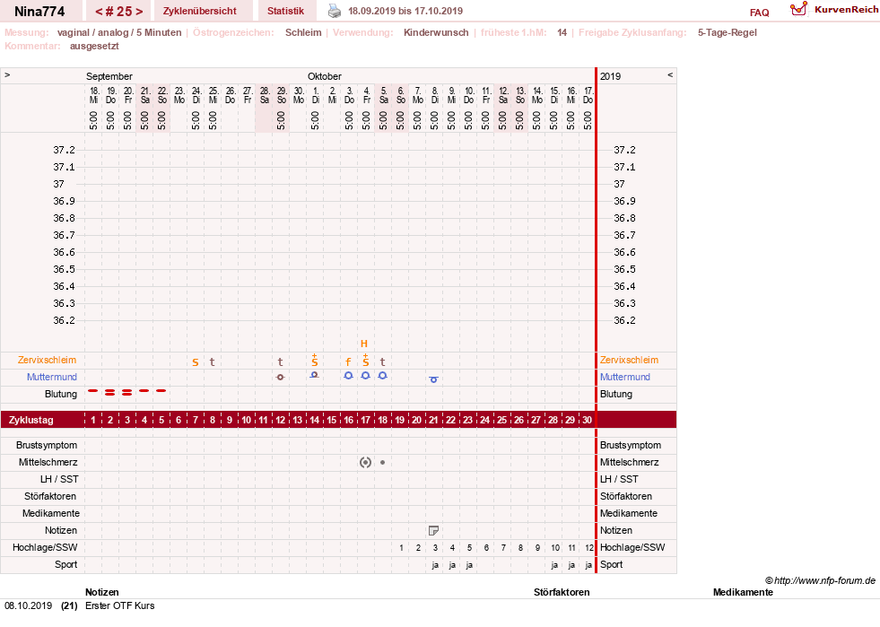 NFP-Kurve User #29626