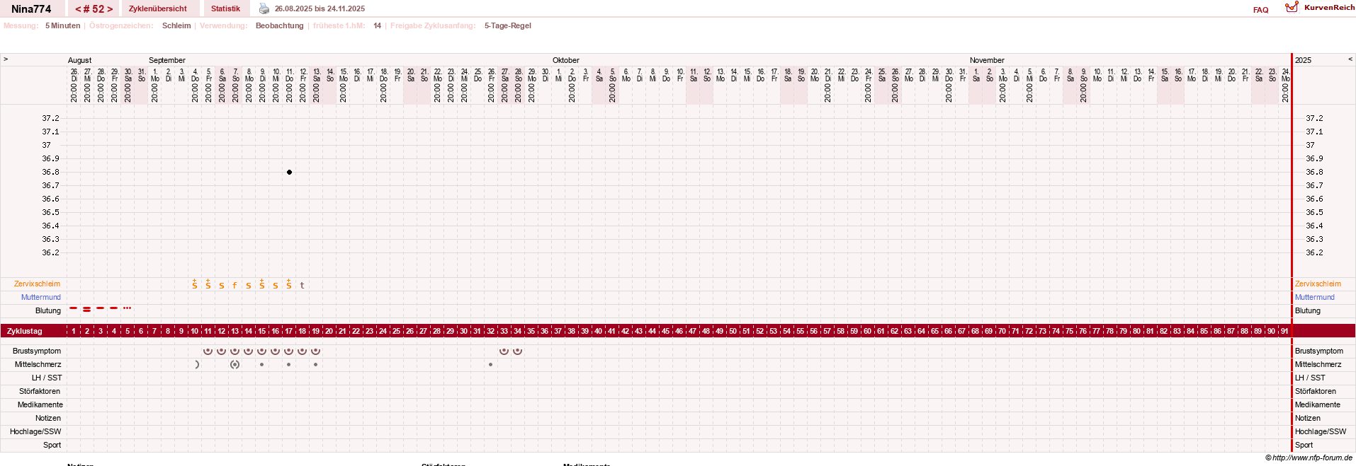 NFP-Kurve User #29626