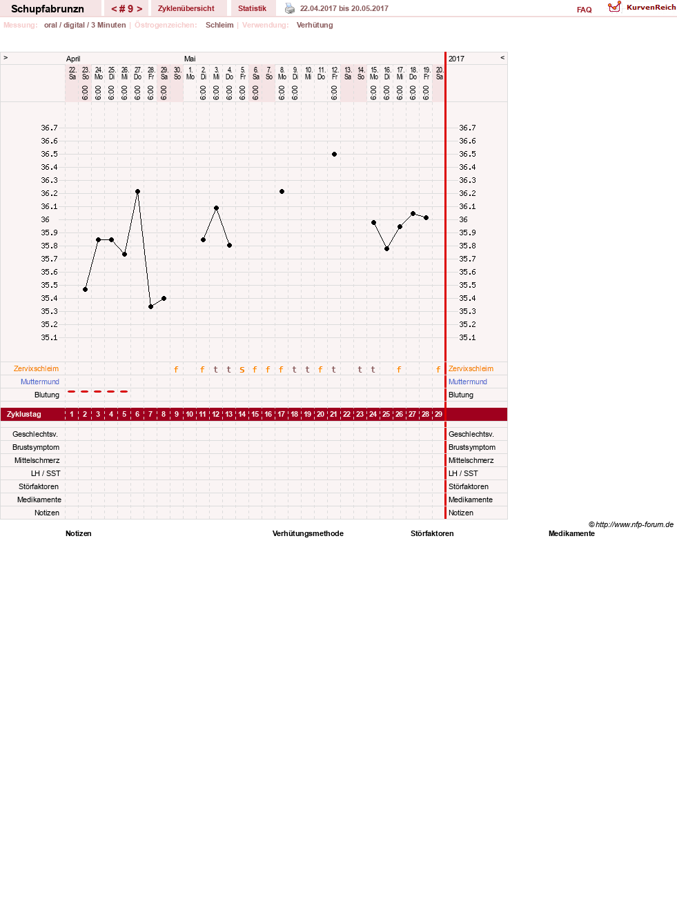 NFP-Kurve User #29783