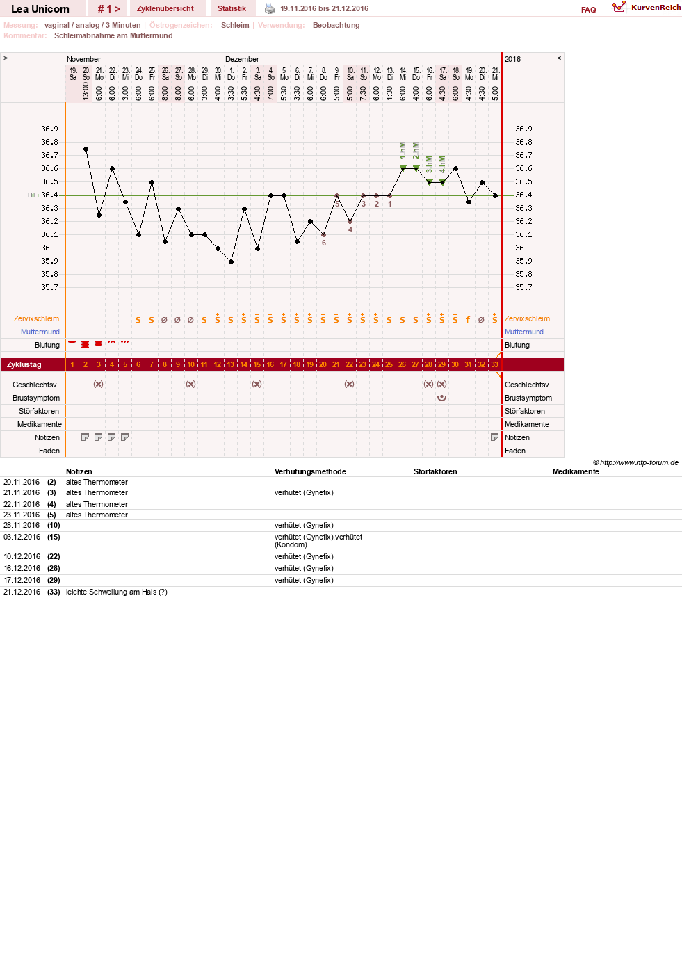 NFP-Kurve User #29938