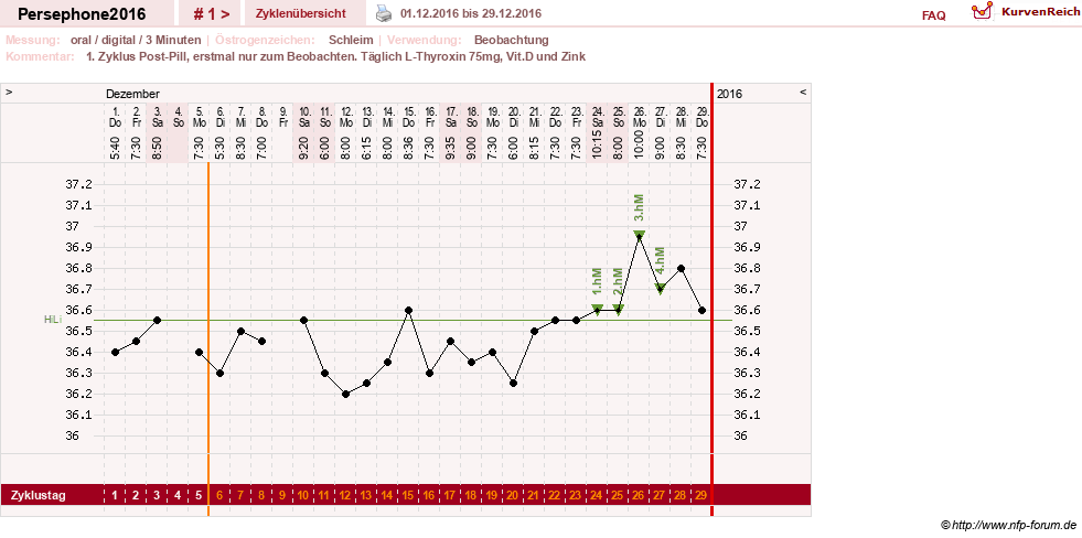 NFP-Kurve User #29979