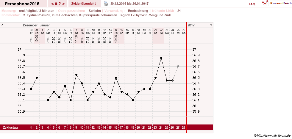NFP-Kurve User #29979