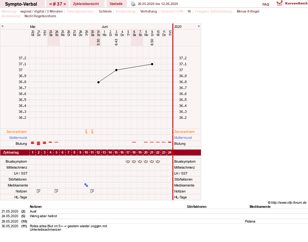 NFP-Kurve User #30009