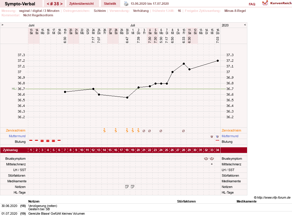 NFP-Kurve User #30009