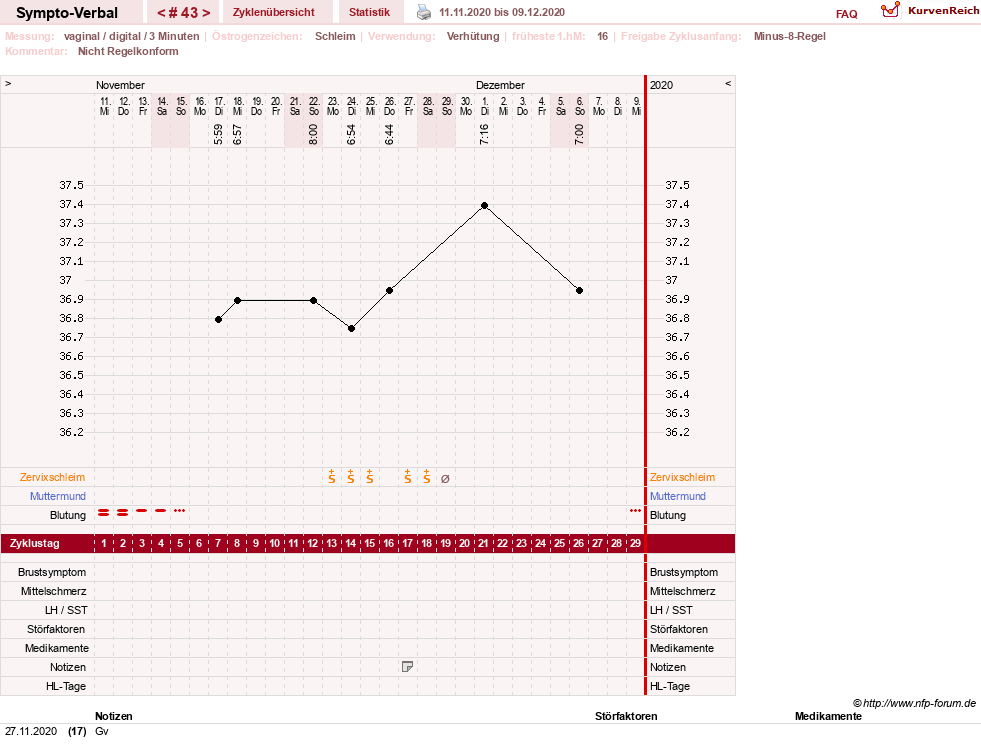 NFP-Kurve User #30009