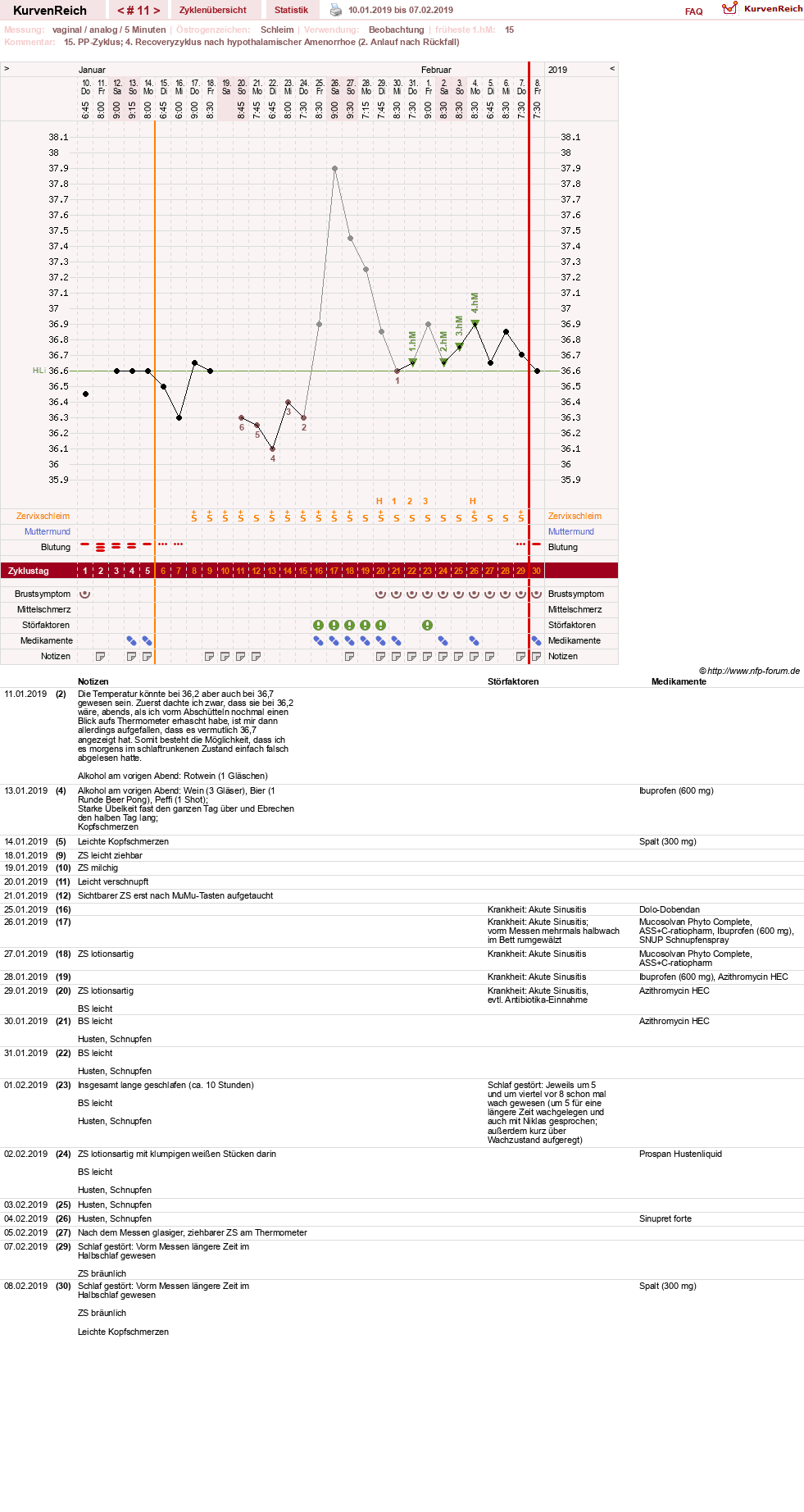 NFP-Kurve User #30045