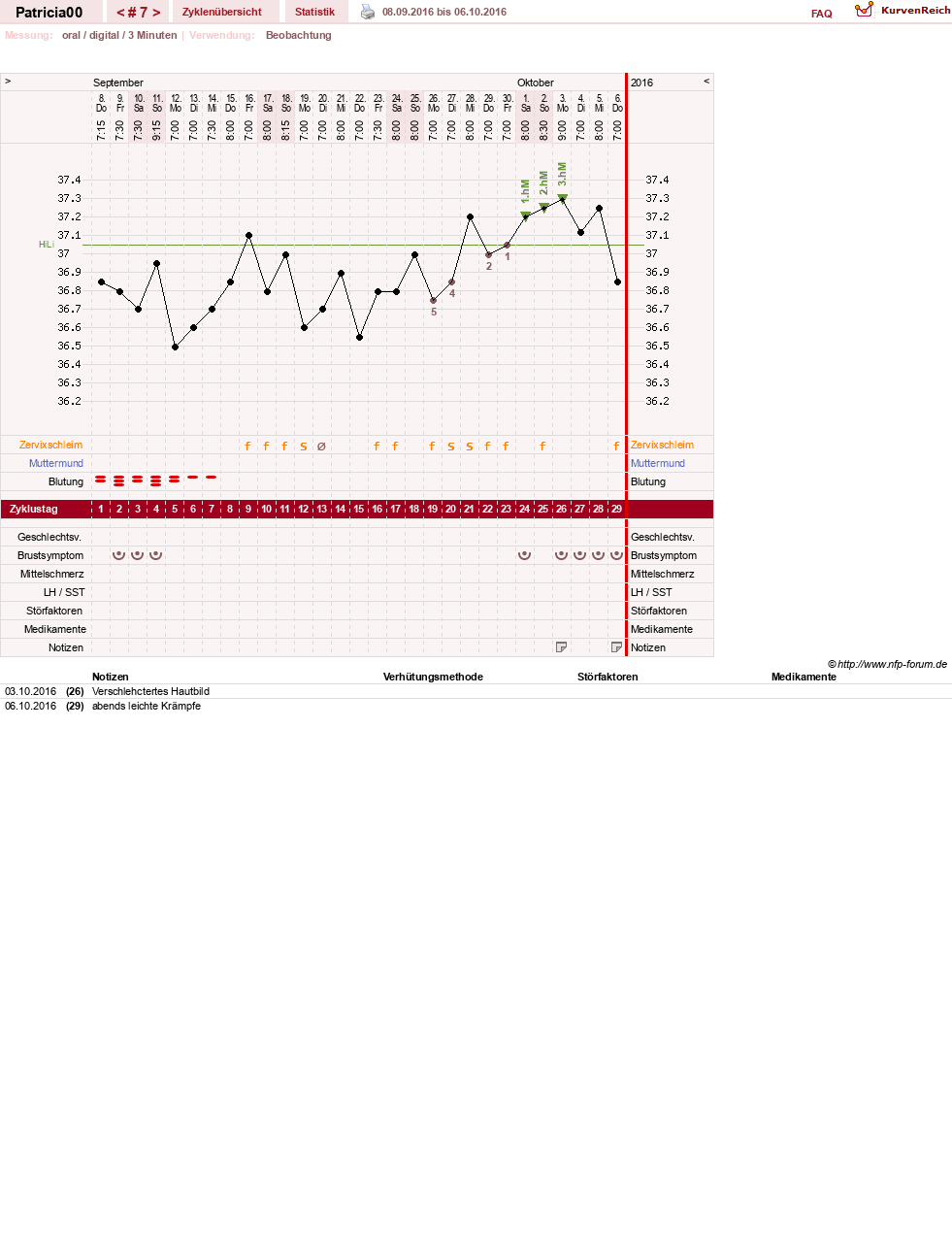 NFP-Kurve User #30073