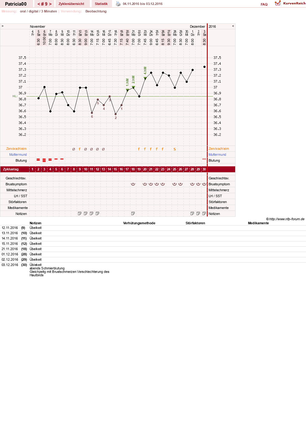 NFP-Kurve User #30073