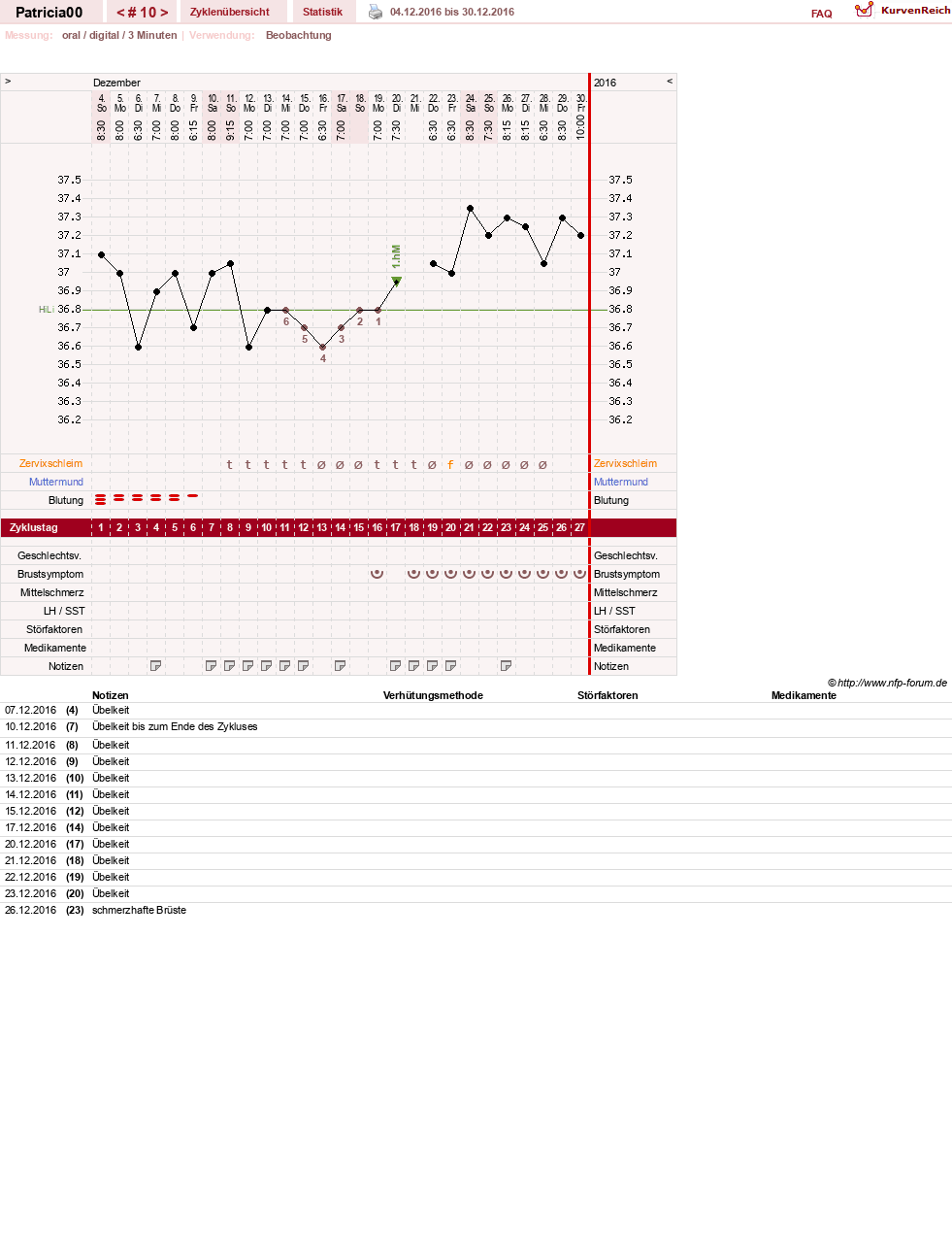 NFP-Kurve User #30073