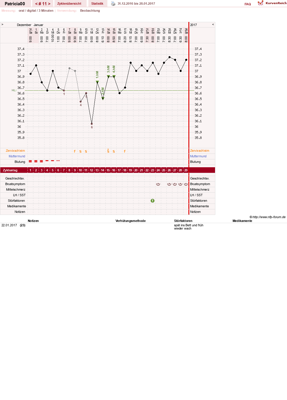 NFP-Kurve User #30073