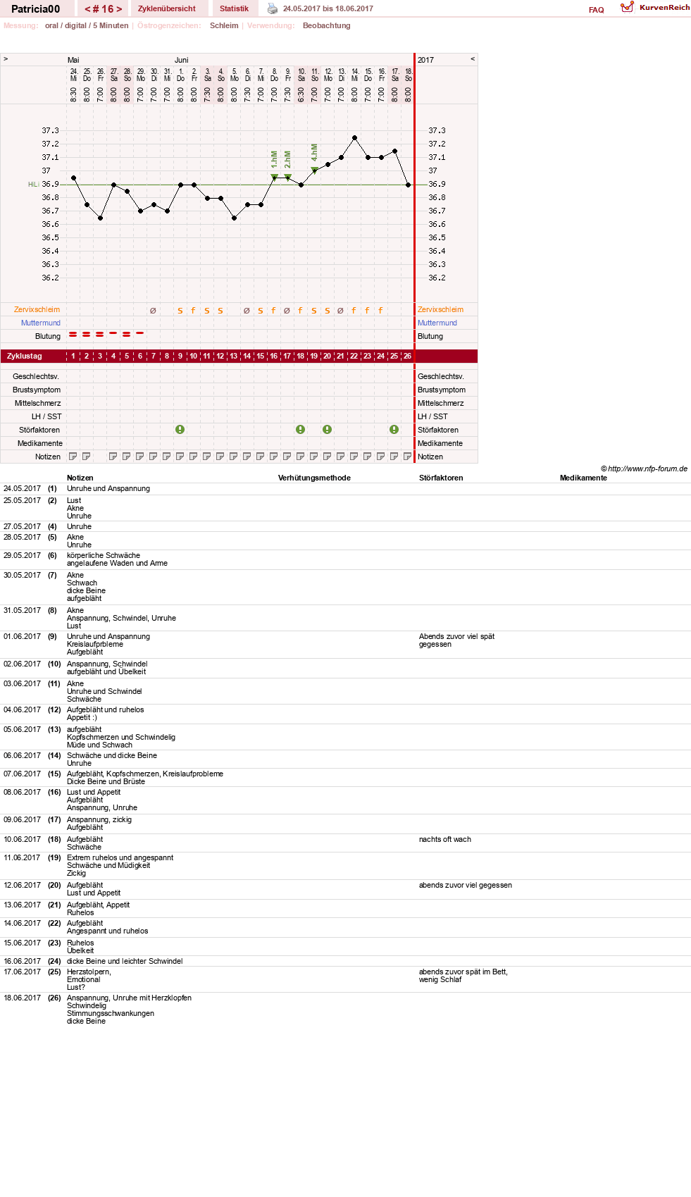 NFP-Kurve User #30073