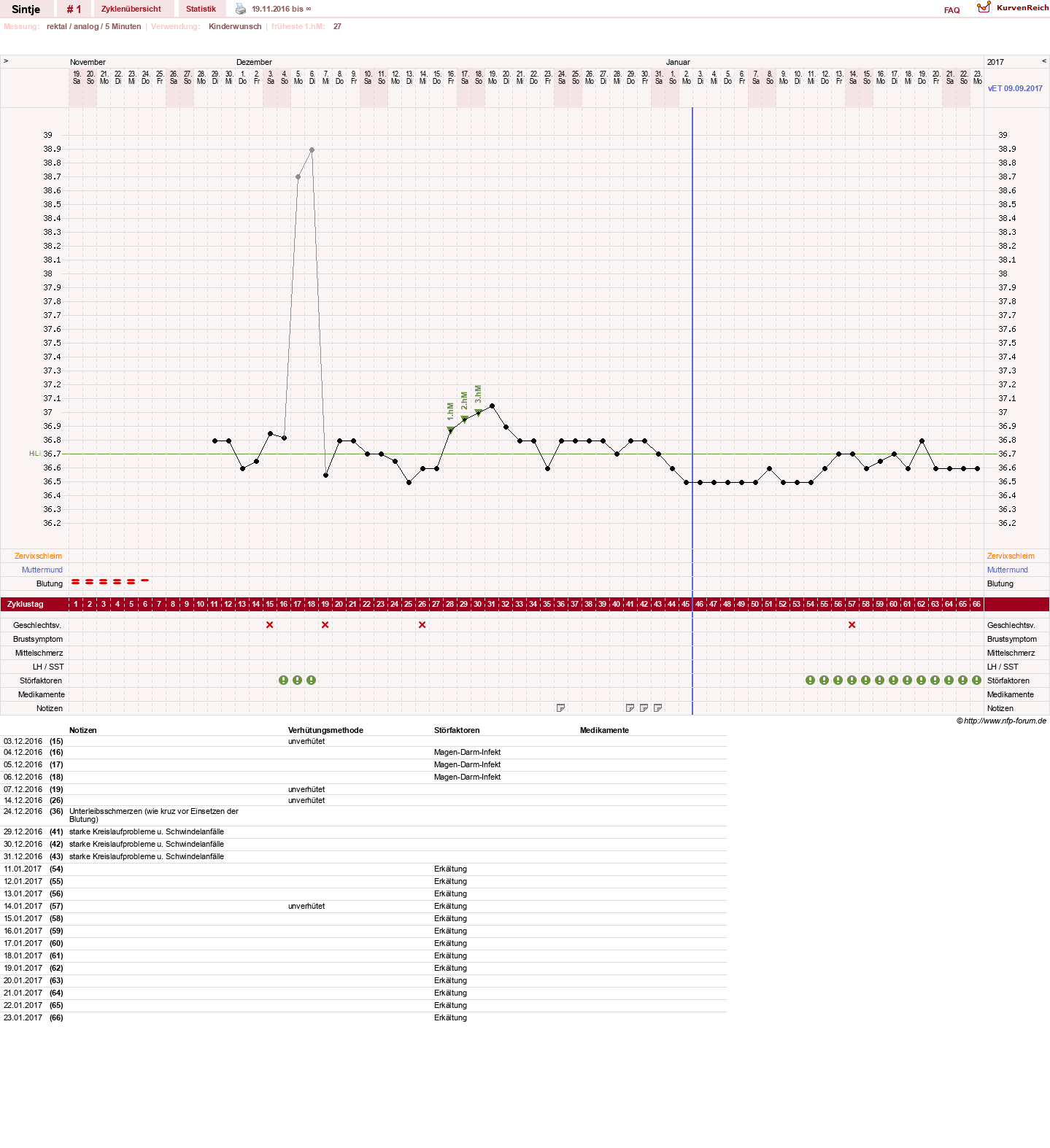 NFP-Kurve User #30092