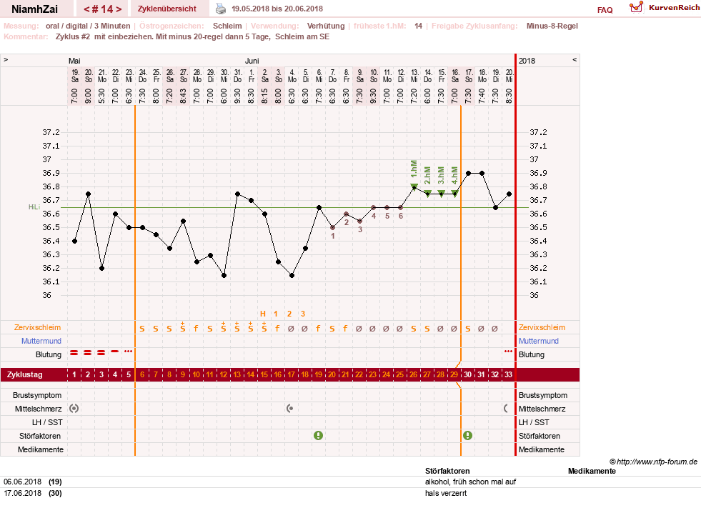 NFP-Kurve User #30185