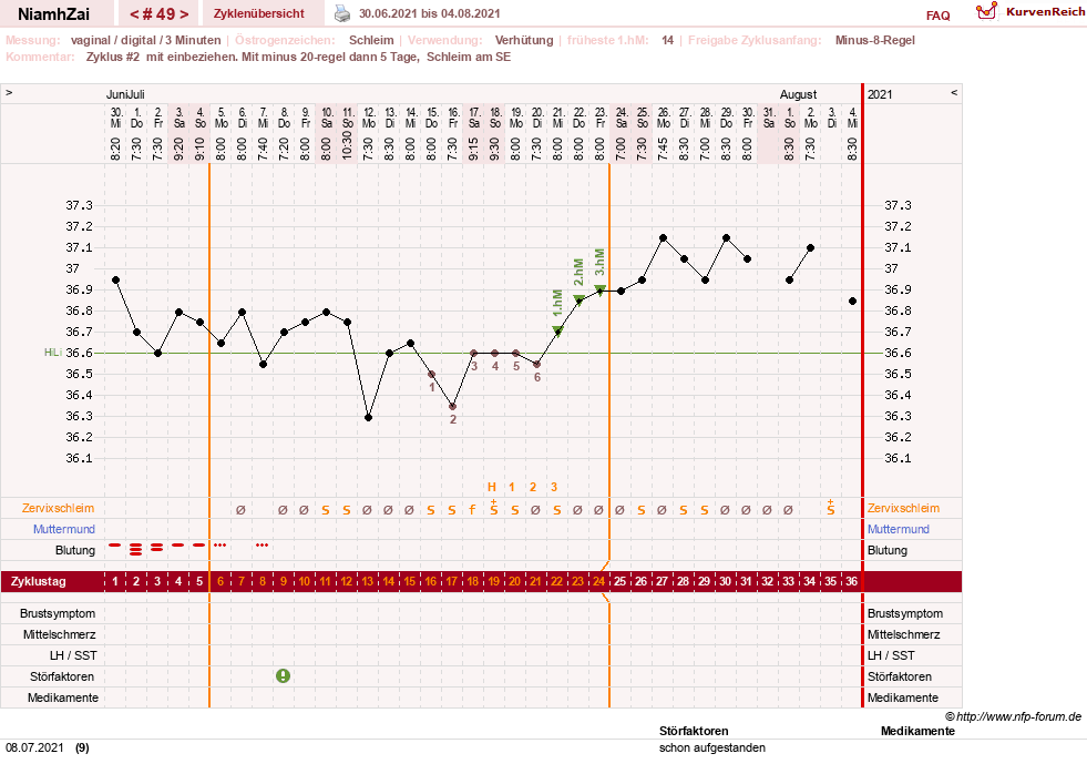 NFP-Kurve User #30185