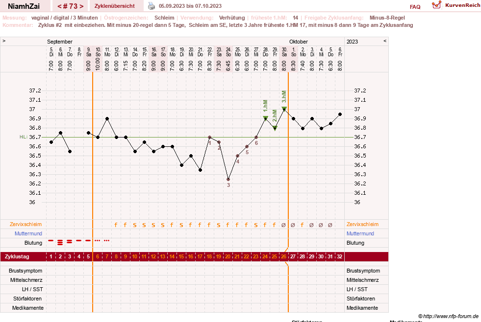 NFP-Kurve User #30185