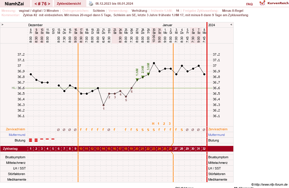 NFP-Kurve User #30185