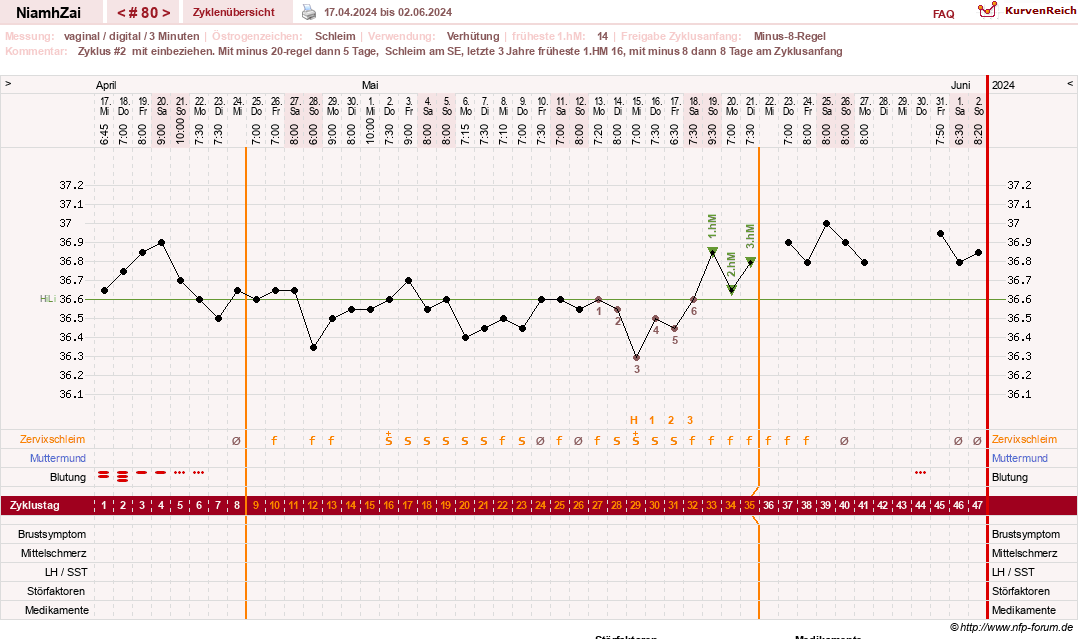 NFP-Kurve User #30185