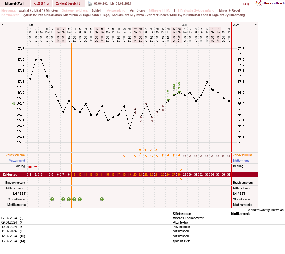 NFP-Kurve User #30185