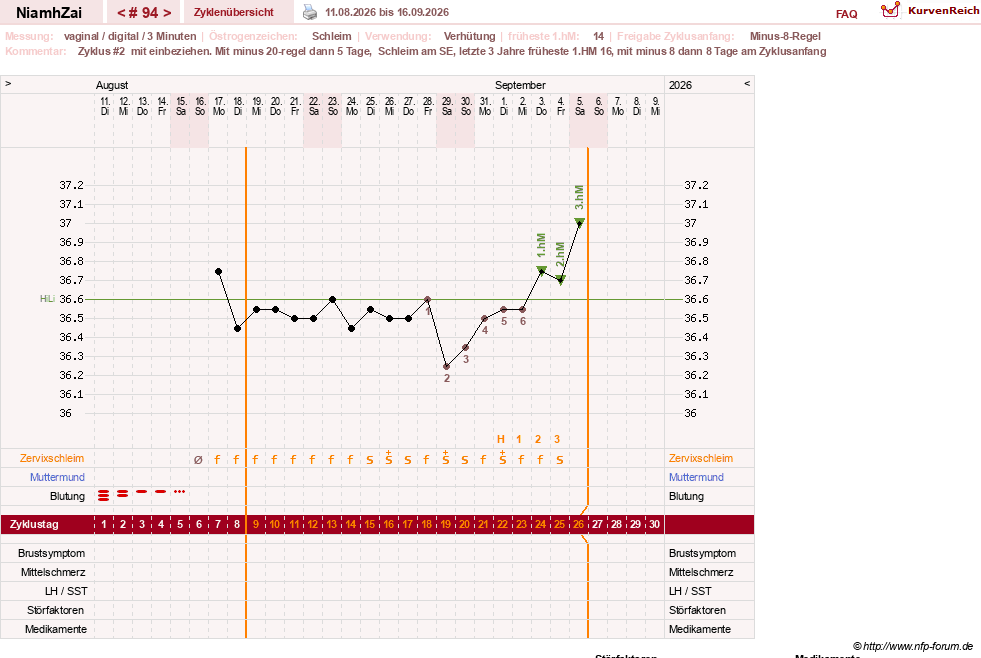 NFP-Kurve User #30185