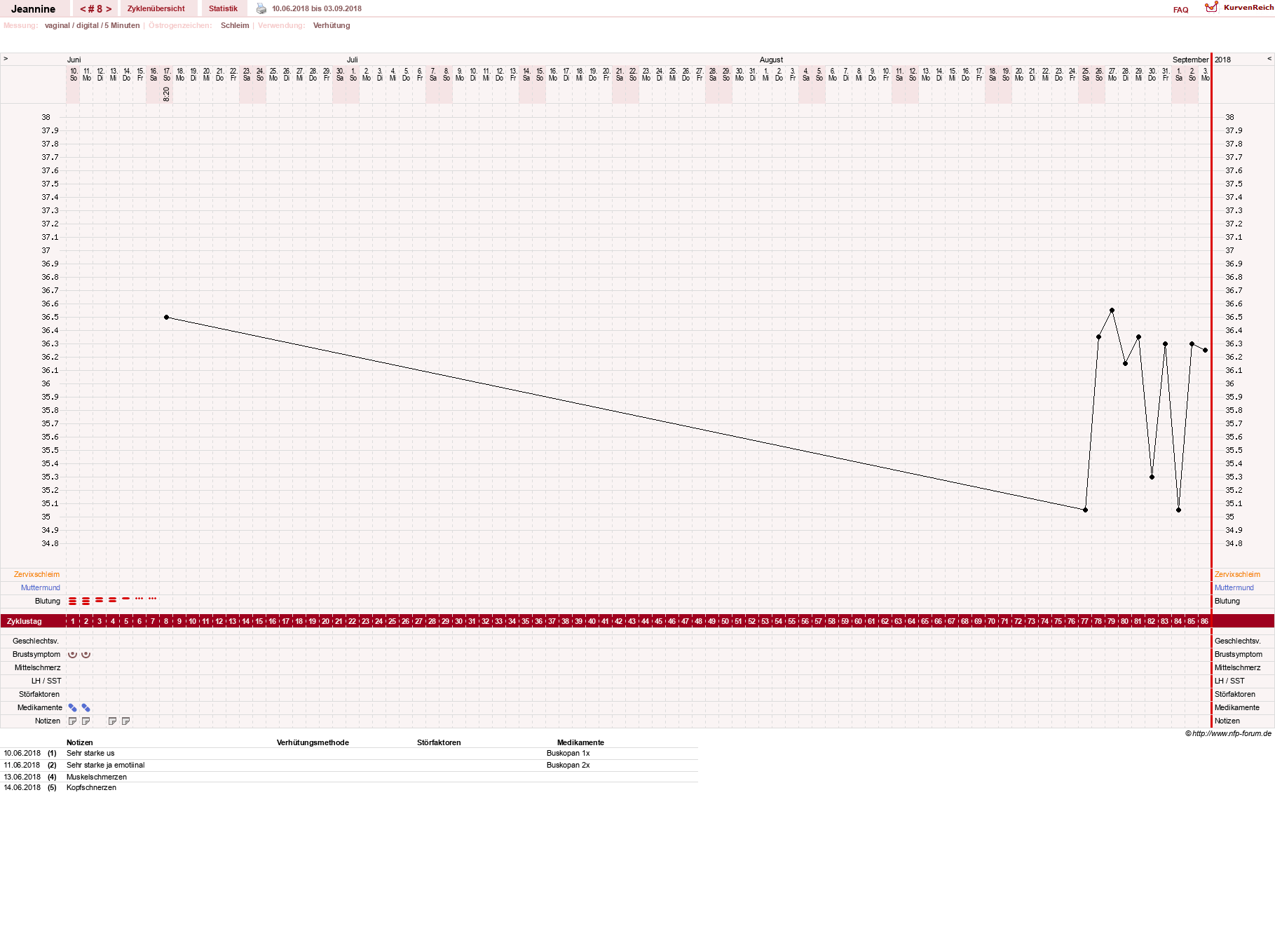 NFP-Kurve User #30217