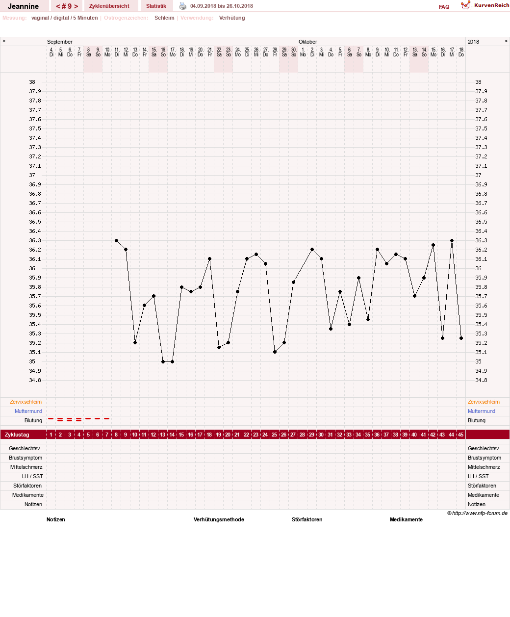 NFP-Kurve User #30217