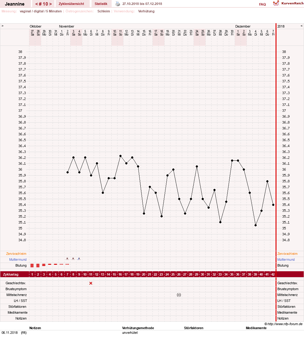 NFP-Kurve User #30217