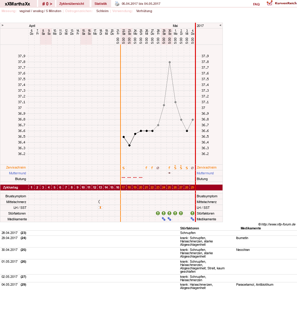 NFP-Kurve User #30309