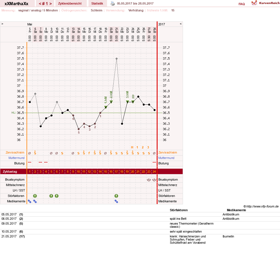 NFP-Kurve User #30309