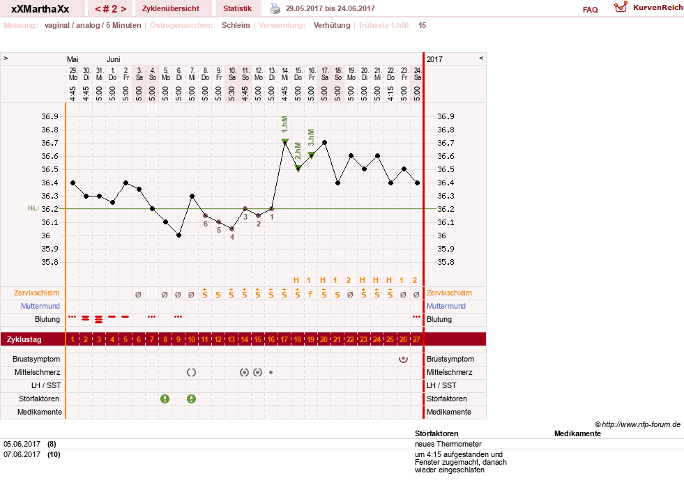 NFP-Kurve User #30309