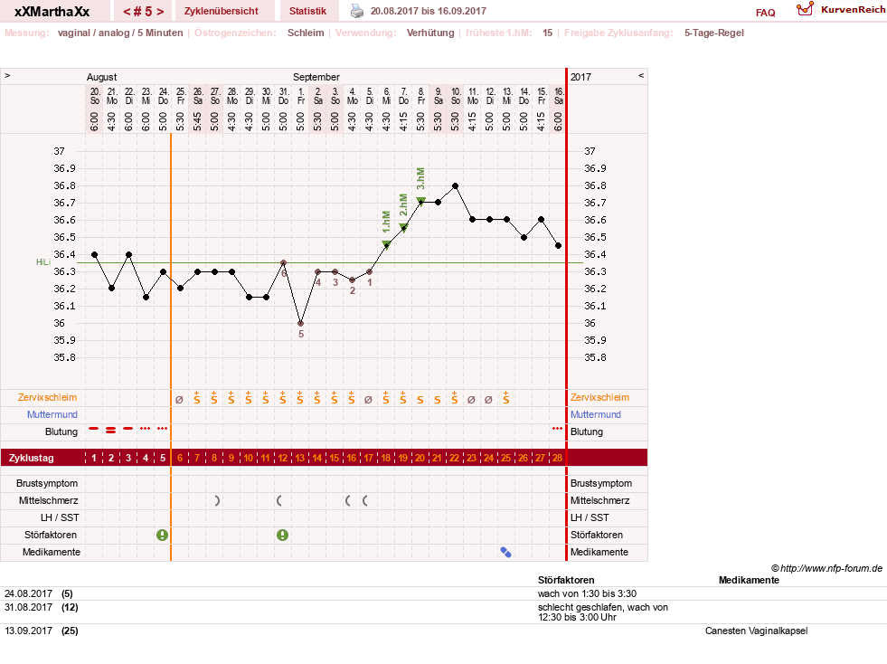 NFP-Kurve User #30309