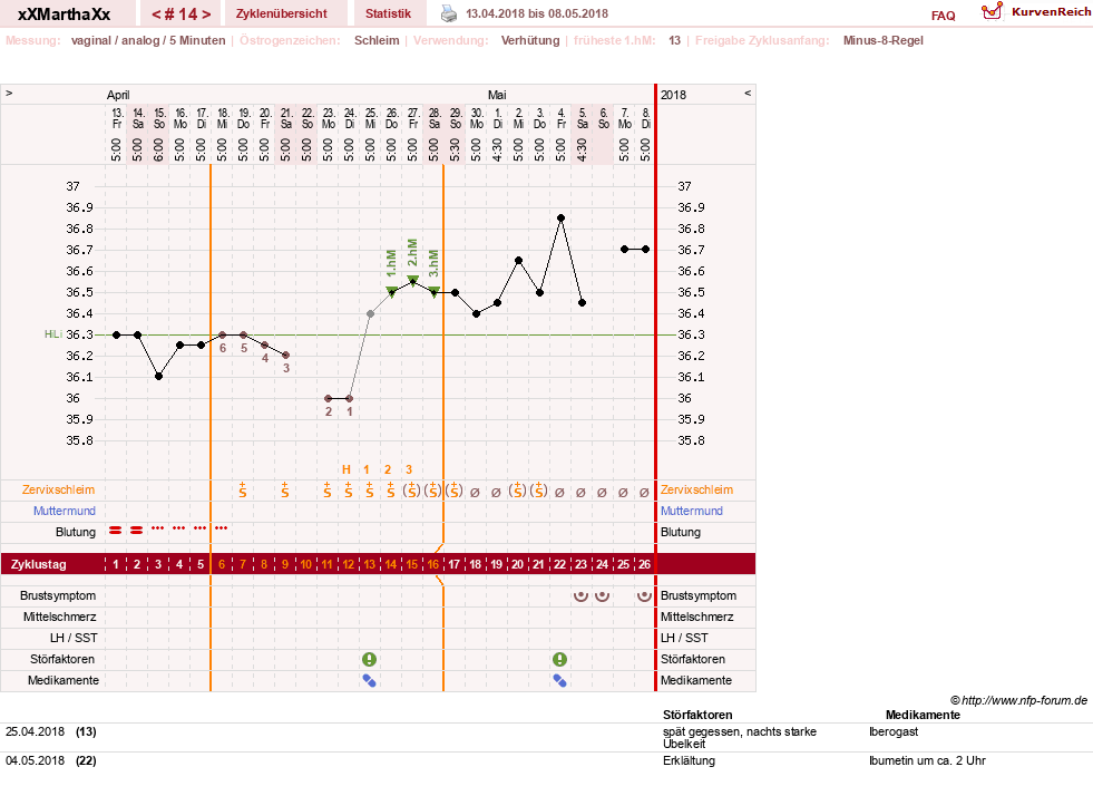 NFP-Kurve User #30309