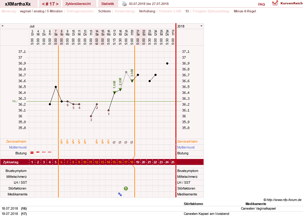 NFP-Kurve User #30309