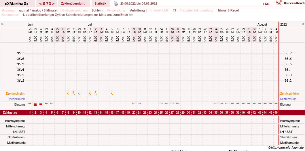 NFP-Kurve User #30309