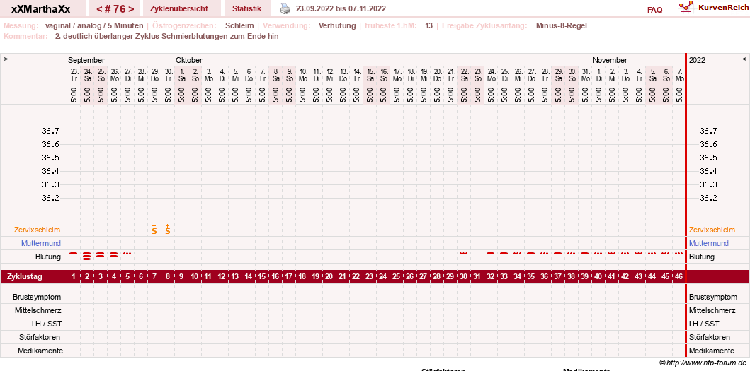 NFP-Kurve User #30309