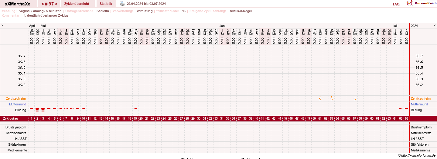 NFP-Kurve User #30309