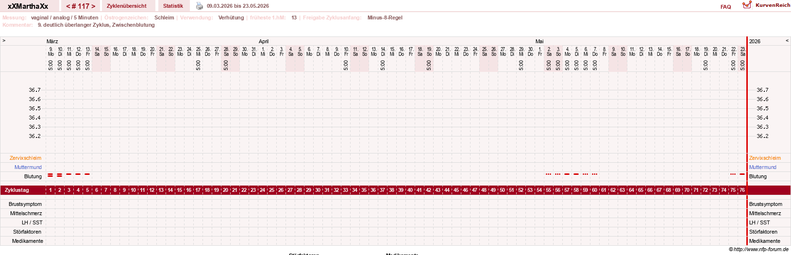 NFP-Kurve User #30309