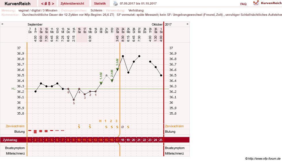 NFP-Kurve User #30417