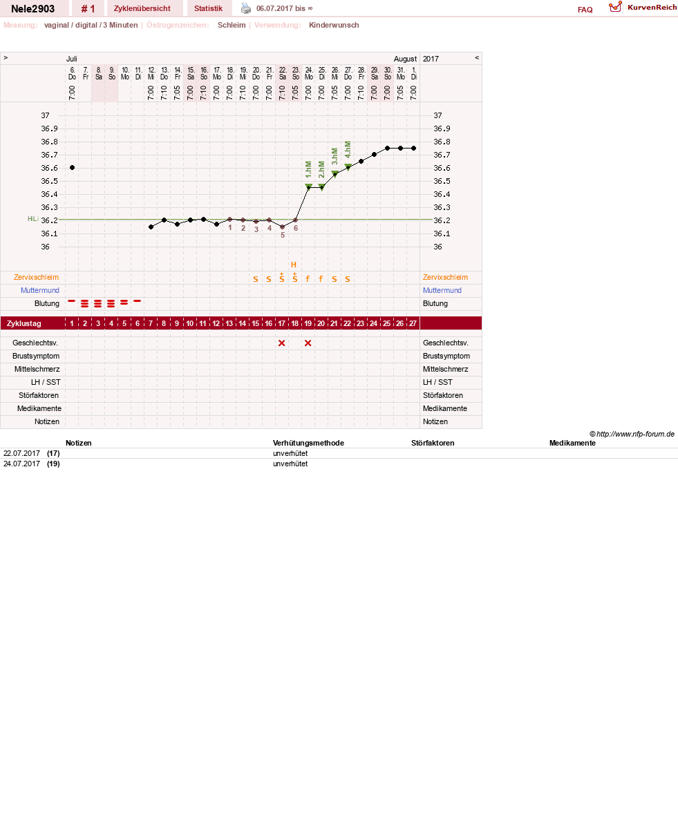 NFP-Kurve User #30563