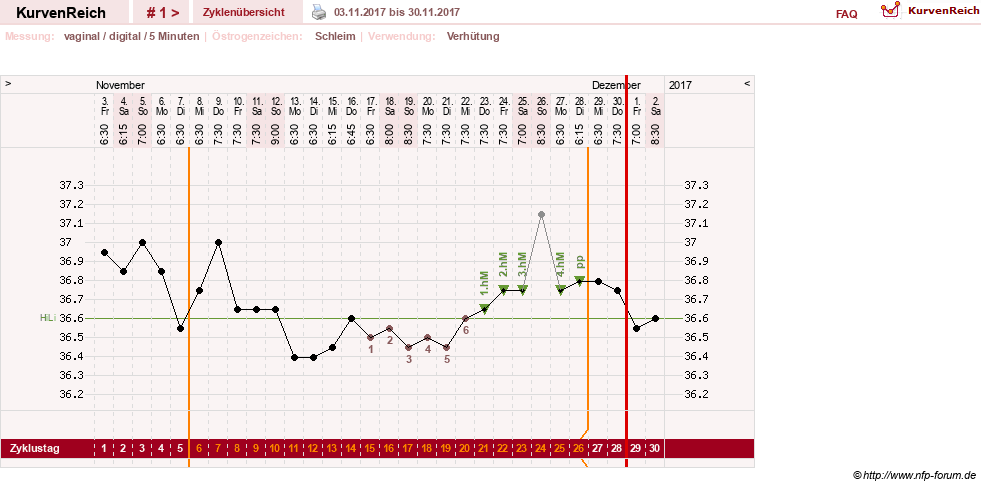 NFP-Kurve User #30724