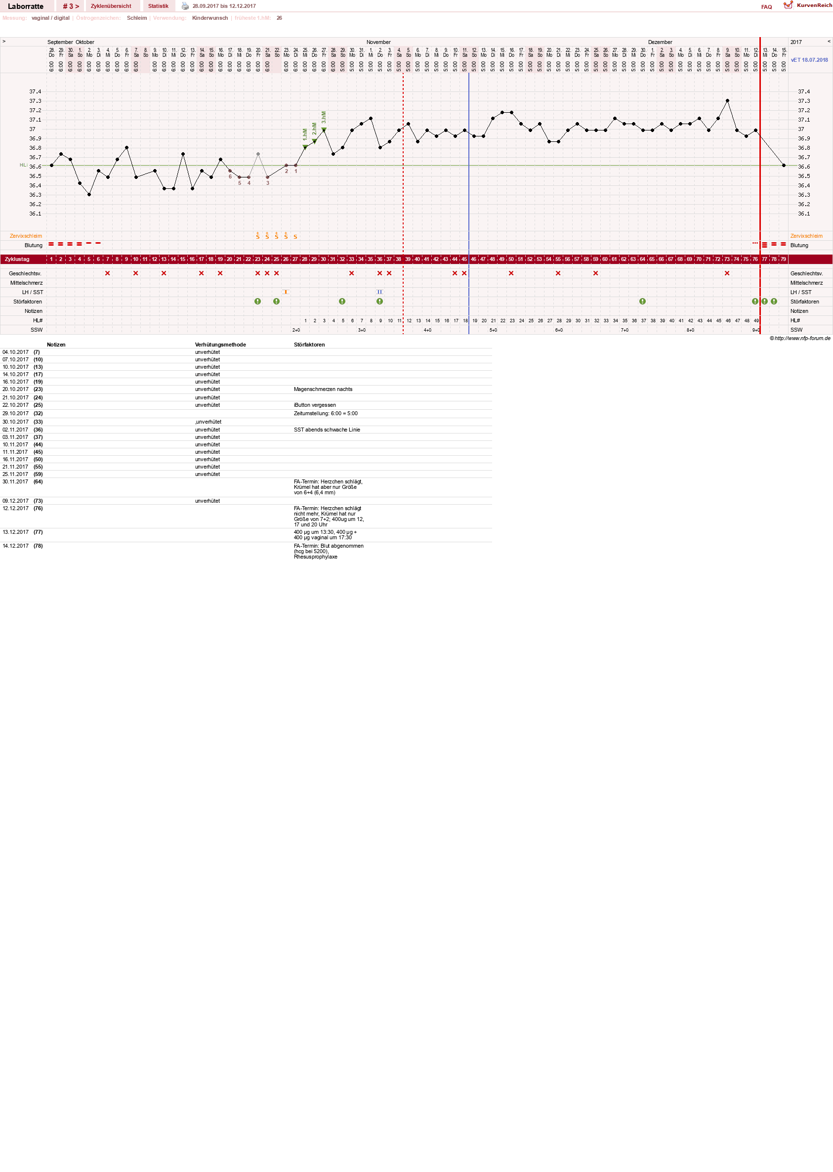 NFP-Kurve User #30725
