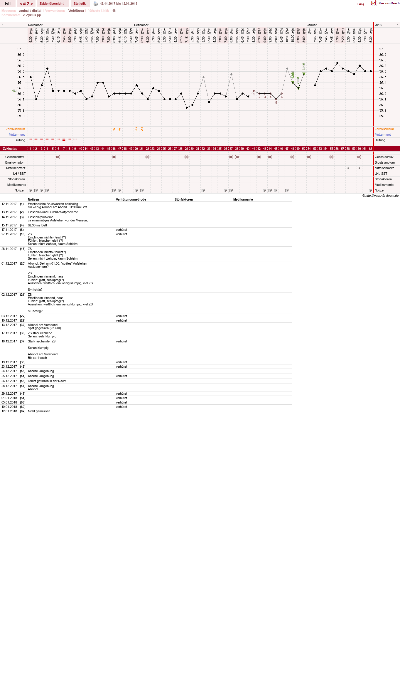 NFP-Kurve User #30741
