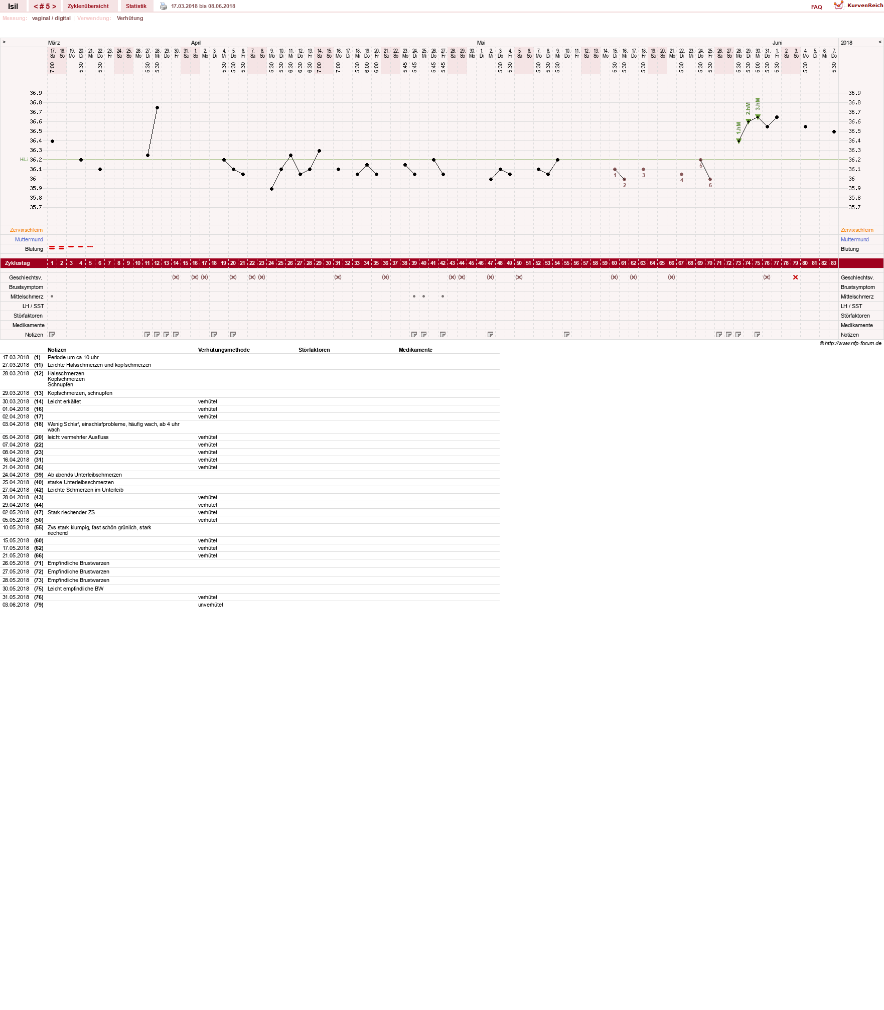 NFP-Kurve User #30741