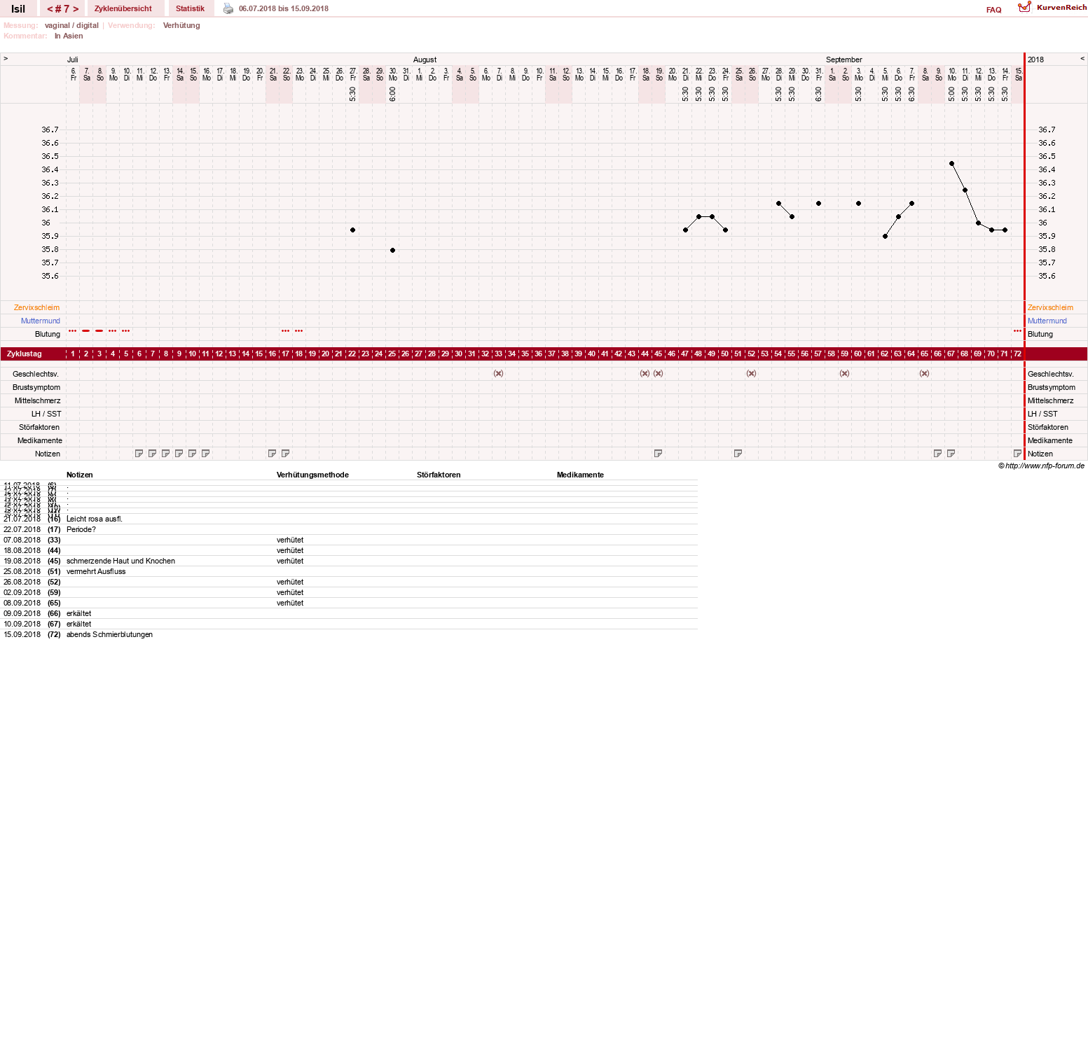 NFP-Kurve User #30741