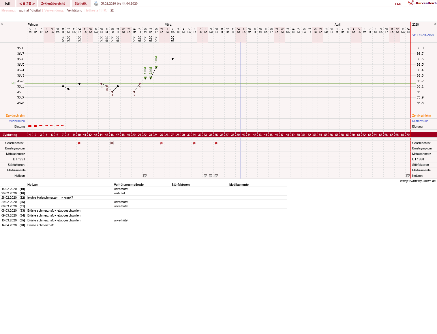 NFP-Kurve User #30741