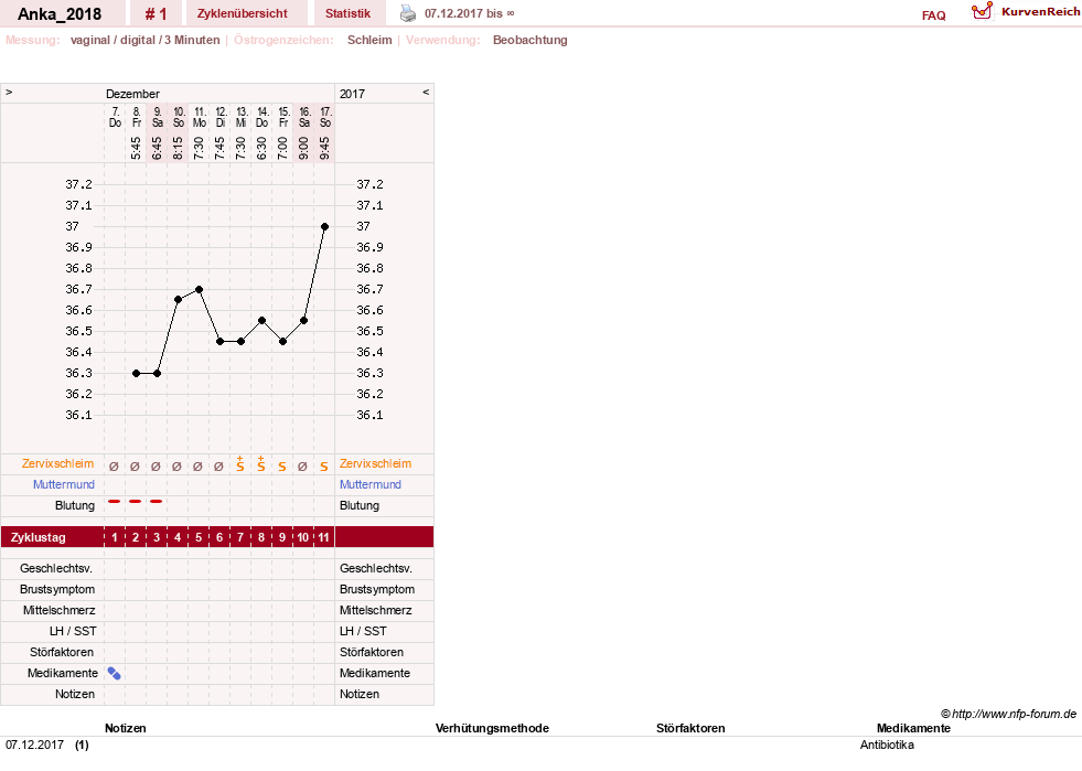 NFP-Kurve User #30881