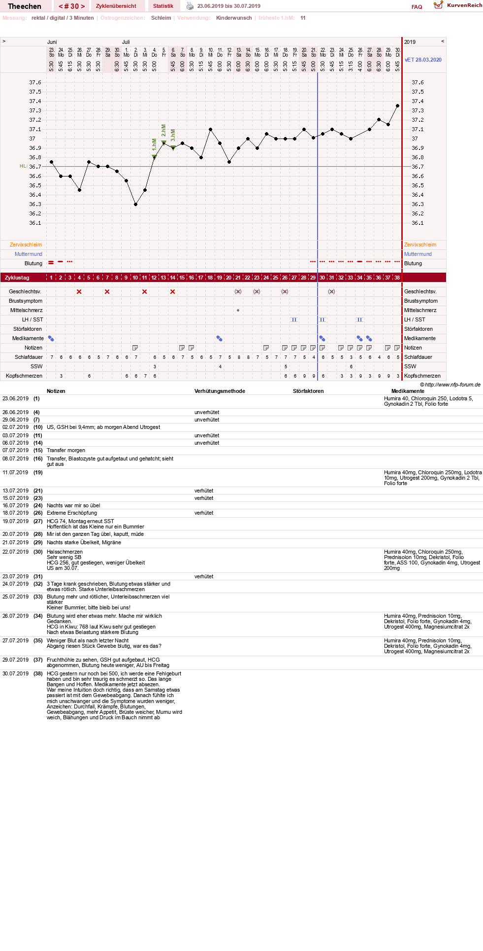 NFP-Kurve User #31018